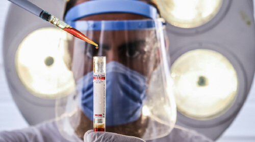 Doctor doing his lab tests research looking at the liquid